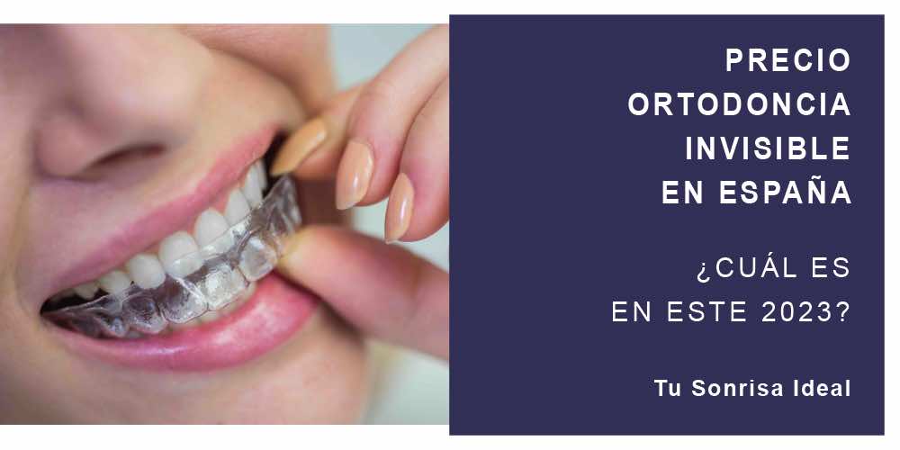 precio espana ortodoncia invisible 2023