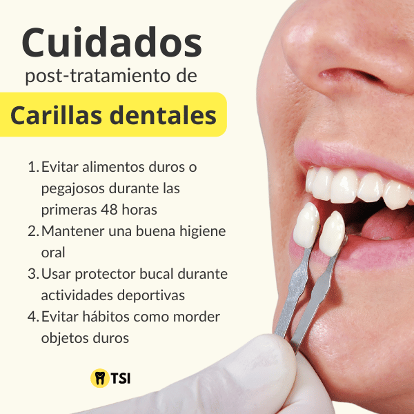 Cuidados post tratamiento de carillas dentales