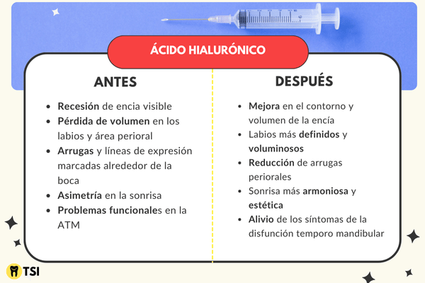 ANTES Y DESPUES ACIDO HIALURONICO