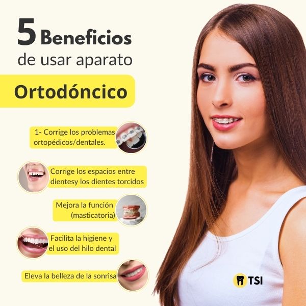 Beneficios de usar aparatos ortodoncicos