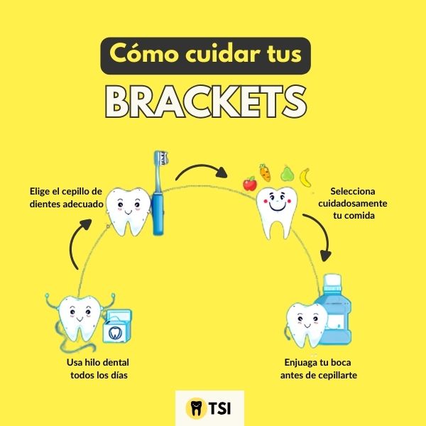 COMO CUIDAR TUS BRACKETS consejos