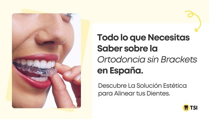 Ortodoncia sin Brackets