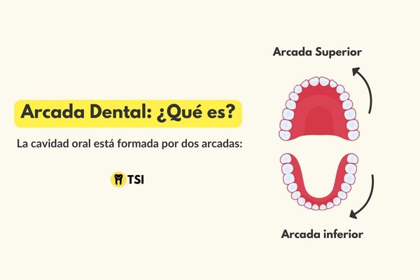 arcada superior y arcada inferior