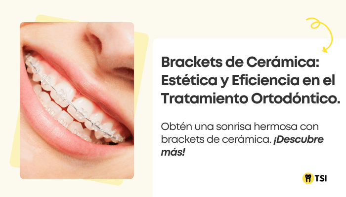 brackets de ceramica estetica y eficiencia en el tratamiento ortodontico