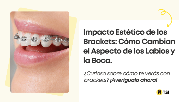 impacto estetico de los brackets como cambian el aspecto de los labios y la boca