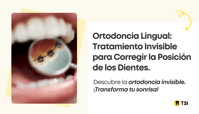 ortodoncia lingual tratamiento invisible para corregir la posicion de los dientes