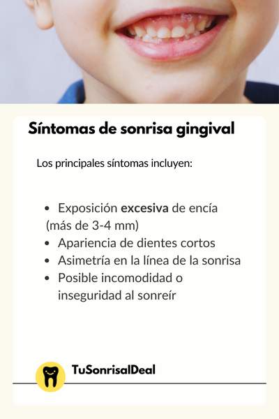 sintomas de la sonrisa gingival