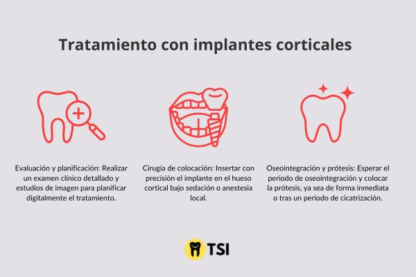 tratamiento de implantes corticales 1