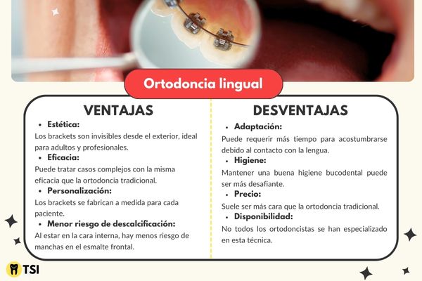 ventajas y desventajas de la Ortodoncia lingual 1