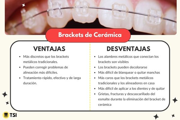 ventajas y desventajas de los brackets de ceramica