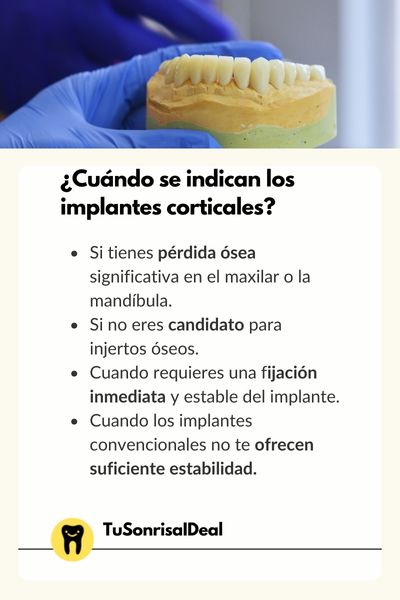 Cuando se indican los implantes corticales 1