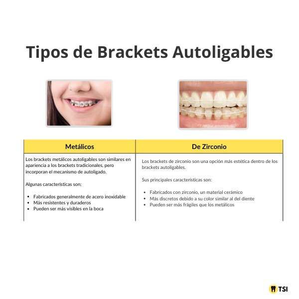 Tipos de Brackets 1