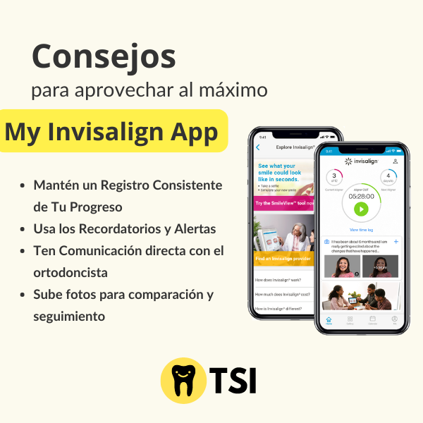 consejos para aprovechar al maximo invisalign app