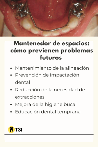 mantenedor de espacio dental como previene problemas