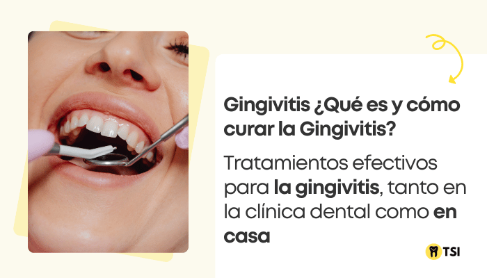 Qué es y cómo curar la Gingivitis