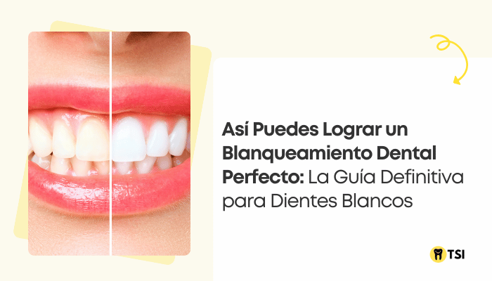 asi-puedes-lograr-un-blanqueamiento-dental-perfecto