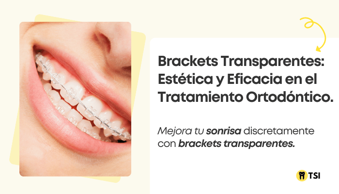 brackets-transparentes-estetica-y-eficacia-en-el-tratamiento-ortodontico