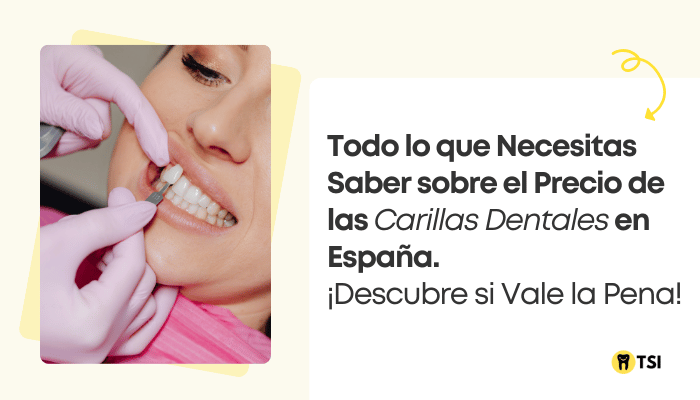 carillas-dentales-precio