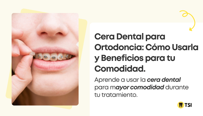 cera-dental-para-ortodoncia-como-usarla-y-beneficios-para-tu-comodidad