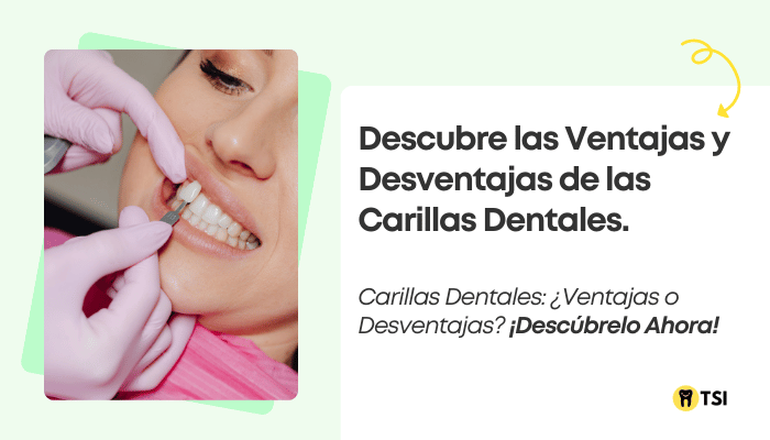 descubre-las-ventajas-y-desventajas-de-las-carillas-dentales