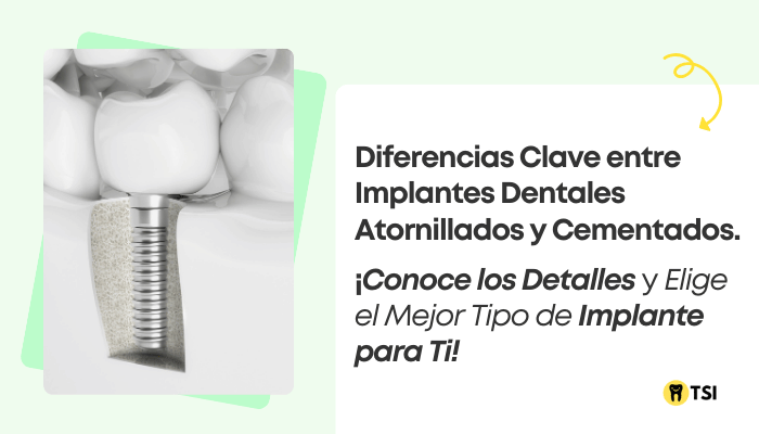 diferencias-claves-entre-implantes-atornillados-y-cementados