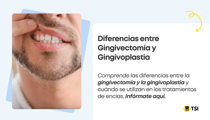 diferencias-entre-gingivectomia-y-gingivoplastia