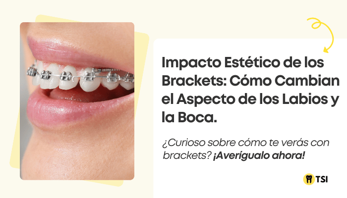 impacto-estetico-de-los-brackets-como-cambian-el-aspecto-de-los-labios-y-la-boca