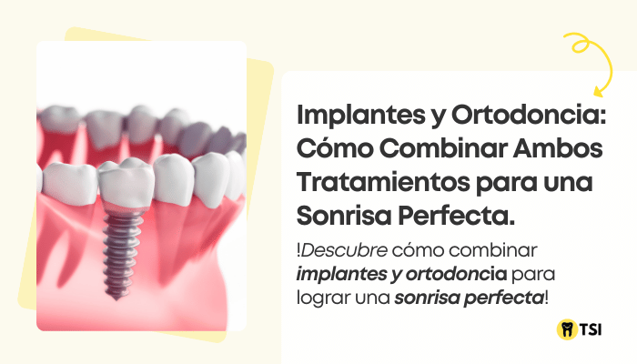 implantes-y-ortodoncia-como-combinar-ambos-tratamientos-para-una-sonrisa-perfecta