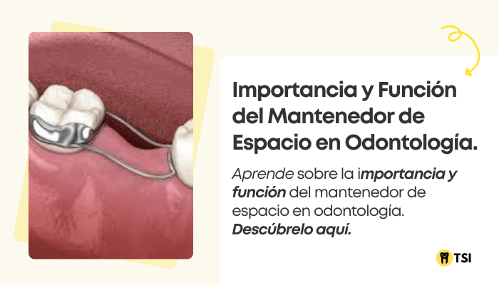 importancia-y-funcion-del-mantenedor-de-espacio-en-odontologia