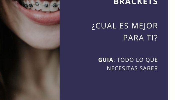 invisalign o brackets