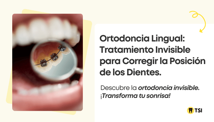 ortodoncia-lingual-tratamiento-invisible-para-corregir-la-posicion-de-los-dientes