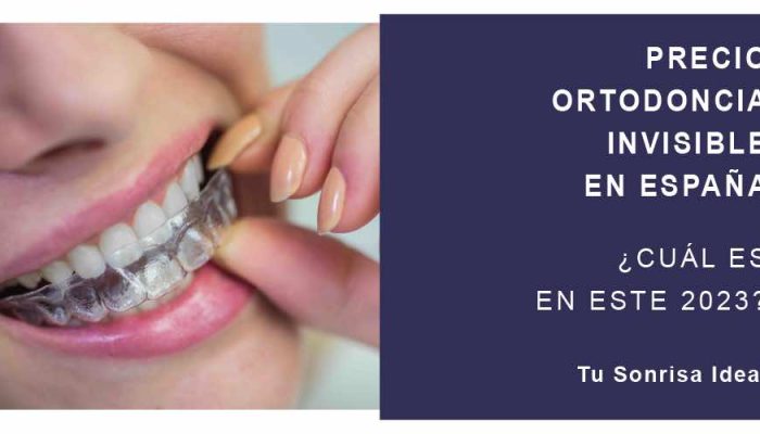 precio-espana-ortodoncia-invisible-2023