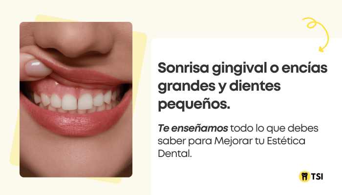 sonrisa-gingival-encias-grandes