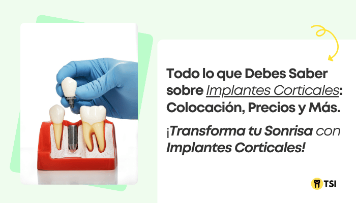 todo-lo-que-debes-saber-sobre-implantes-corticales